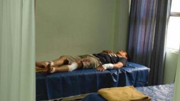 Sadis! Setelah Dikeroyok Anton Dibacok Lagi di Kawasan Pelita Batam