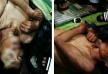 Bilman Sinaga Diduga Dibunuh, Enam Luka Berlubang Ada Pada Kepala