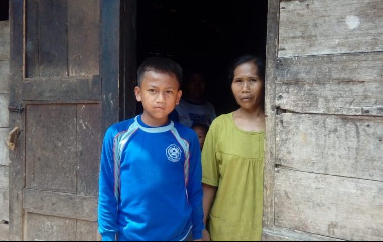 Anak 12 Tahun Ini tak Malu lagi Kulupnya Dipotong