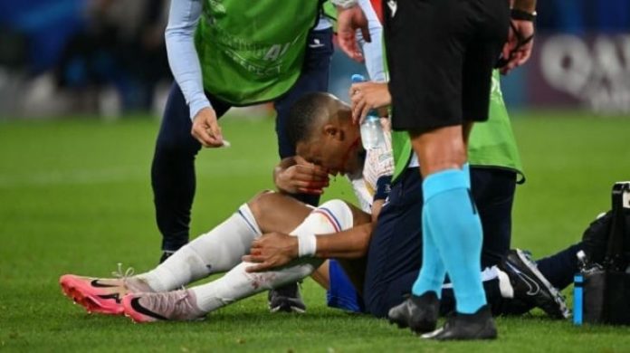 Euro 2024, Prancis Menang Tipis 1-0 atas Austria: Mbappe Cedera Parah