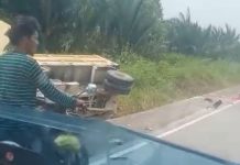 Marlina Mengalami Patah Tulang, Setelah Ditabrak Truk di Karimun