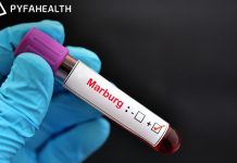 Waspada, Virus Marburg Tewaskan 6 Orang di Rwanda, Kenali Apa Saja Gejalanya Virus Marburg Rwanda